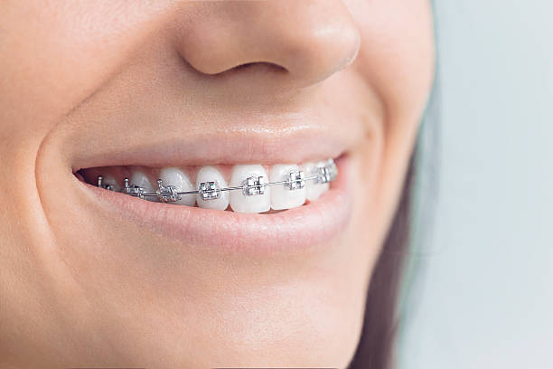 Best Veneers and Lumineers  in Marlton, MD